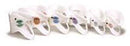 Complete Medical Stifneck Extrication Collar-Baby No-Neck