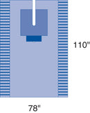 Medline EENT Surgical Pack II, Eclipse