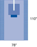 Medline EENT Surgical Pack I, Eclipse
