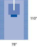 Medline EENT Procedure Pack IV