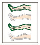 Neomedic INTERMITTENT NON-SEGMENTAL COMPRESSION CIRCULATOR