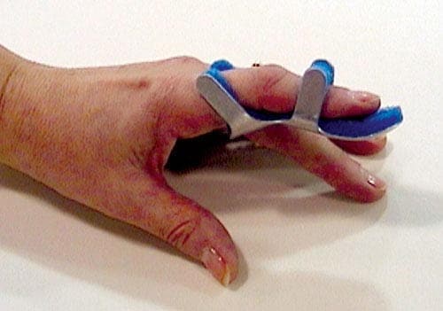 Complete Medical Orthopedic Care Complete Medical Toad Finger Splint Large Bulk  PK/6 Non-Retail